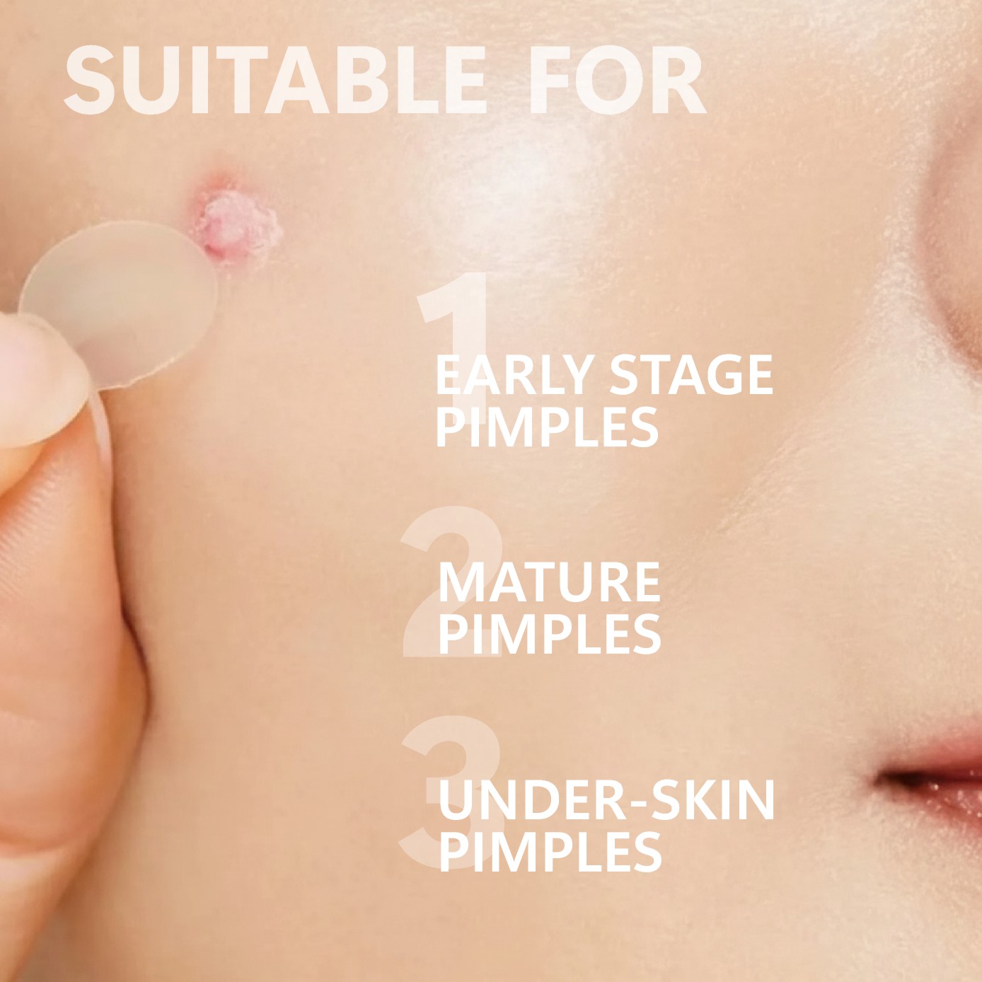 Micro Needle Pimple Patch (24  - Face Moisturizer review and price